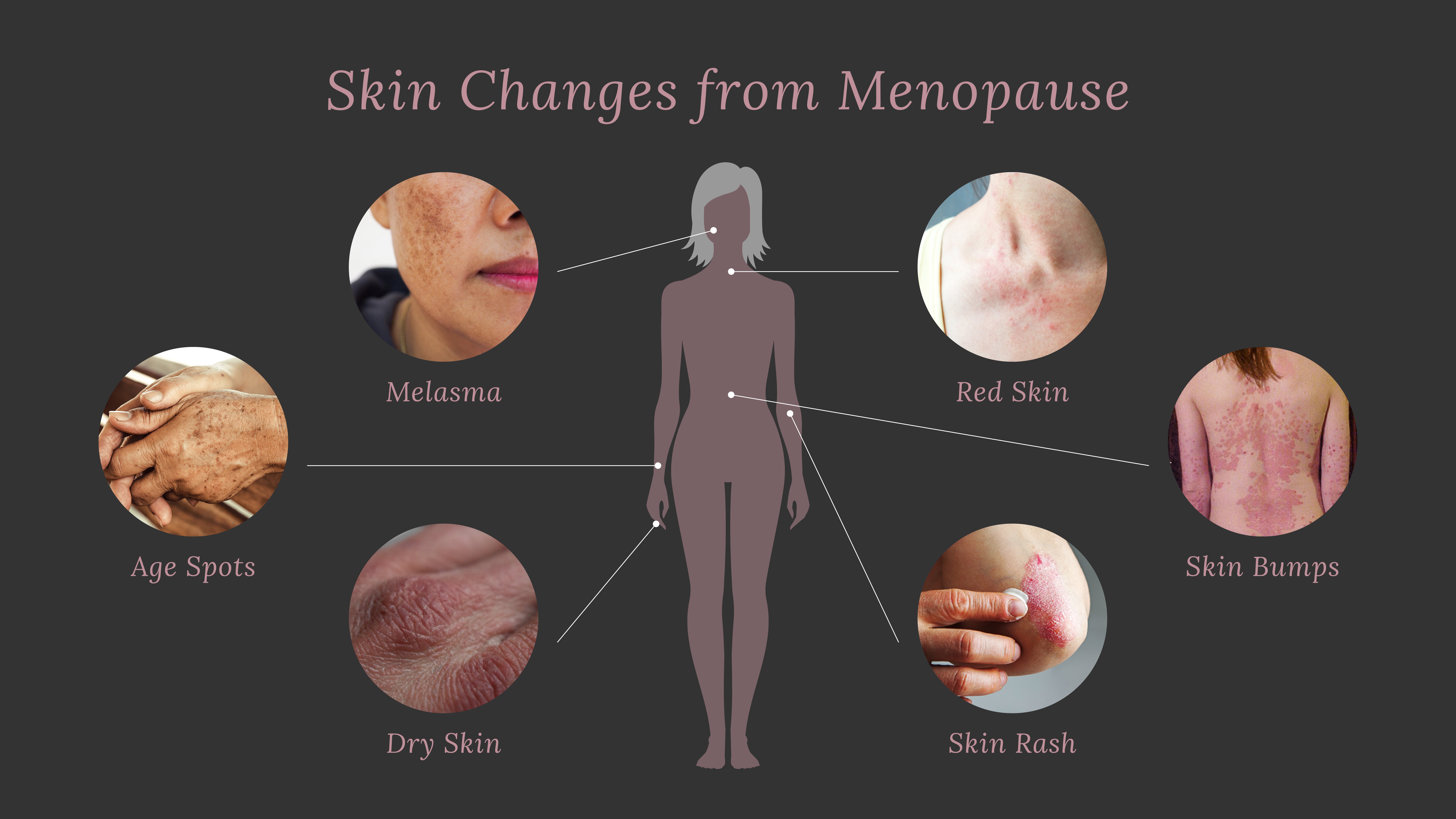 Itchy skin? Are you "Menopause"ing?